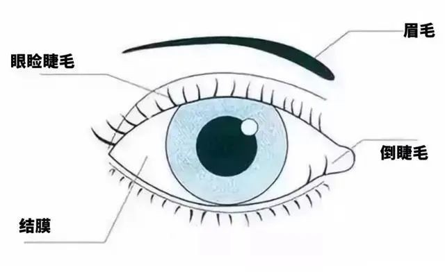 普瑞眼科|新手父母必须了解的六种儿童常见眼病